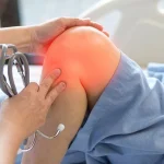 فیزیوتراپی آرتروز زانو