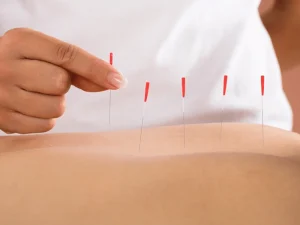 ایا سوزن خشک درد دارد؟