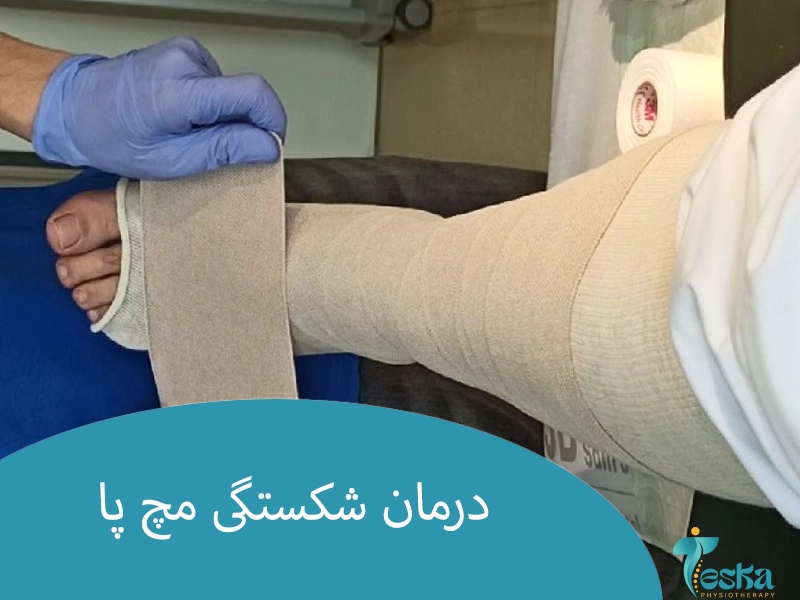 درمان شکستگی مچ پا