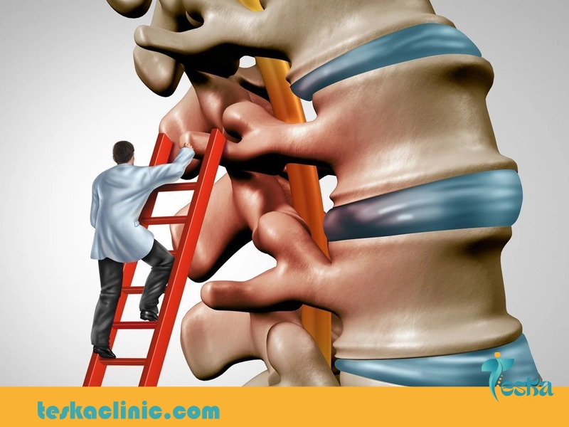 فیزیوتراپی ستون فقرات برای دیسک کمر و دیسک گردن